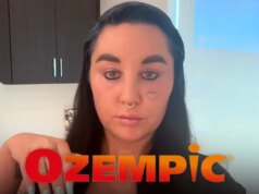 Amanda Bynes Mengungkapkan Berapa Banyak Berat Badan yang Dia Turunkan dalam Perjalanan Ozempic