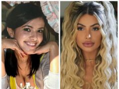 A ‘mulher mais perfeita’ do mundo diz que não consegue mais se reconhecer em fotos antigas – depois de gastar quase US$ 90 mil em cirurgia plástica