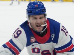 Matthew Tkachuk canta Leon Draisaitl: ‘Sempre uma dama de honra’