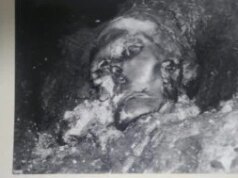 Cirurgiões da Idade do Ferro consertaram a mandíbula quebrada de uma mulher com uma prótese primitiva – e ela sobreviveu