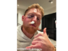 Stokes saiu com um enorme olho roxo após ser atingido por uma bola de críquete